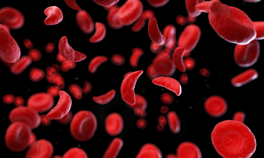 PENTAZOCINE ABUSE AMONG SICKLE CELL PATIENTS IN NIGERIA